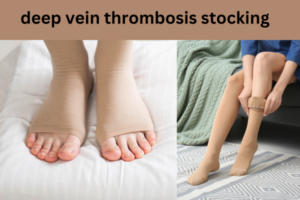 deep-vein-thrombosis-stocking